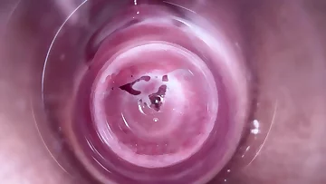 Camera deep inside teen creamy vagina