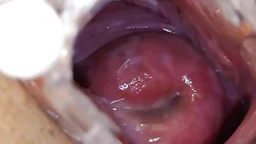 Speculum in a tight madam medic pussy